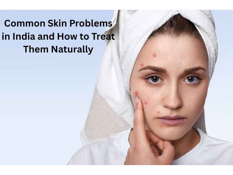 Read more about the article Common Skin Problems in India and How to Treat Them Naturally