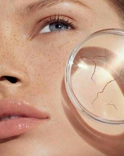 “Close-up of dry, flaky skin on cheek due to dehydration” | ratenguide.com